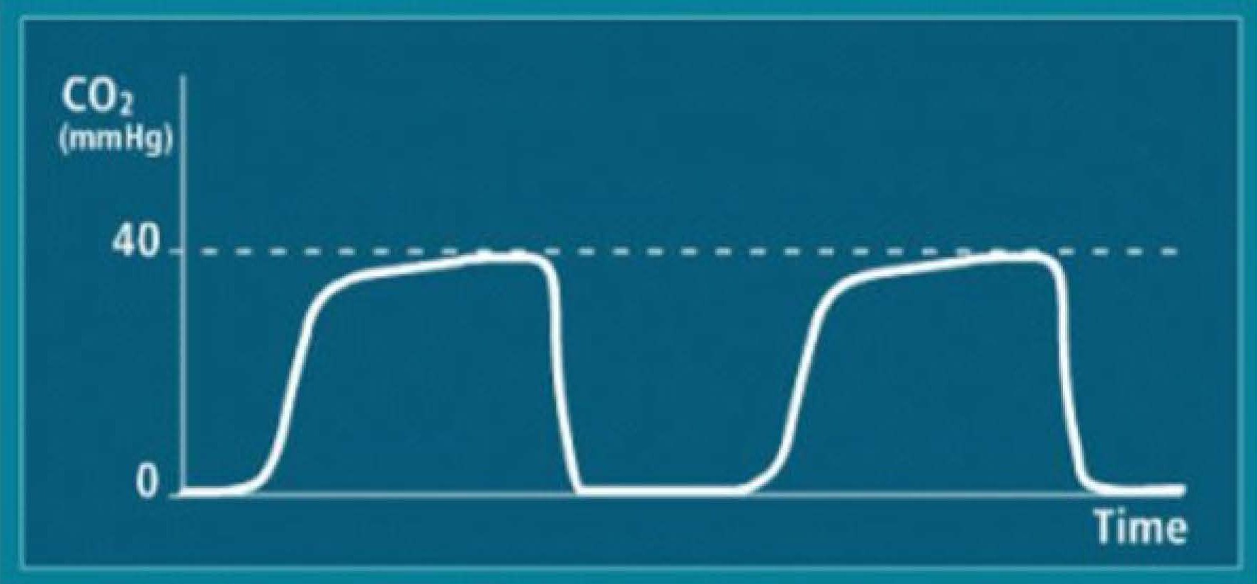 Capnography 101 Banner